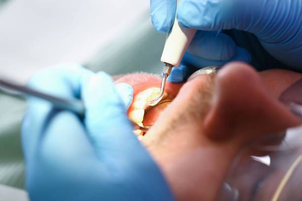 Best Emergency Root Canal Therapy in Millington, TN