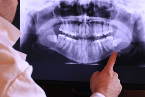 Best Emergency Treatment for Jaw Pain or Injury in Millington, TN