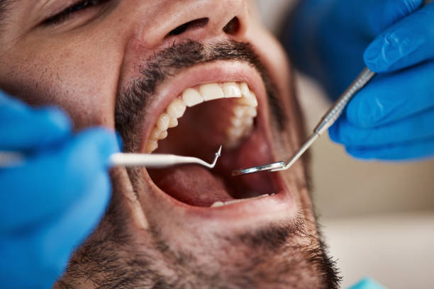 Best Broken or Chipped Tooth Repair in Millington, TN